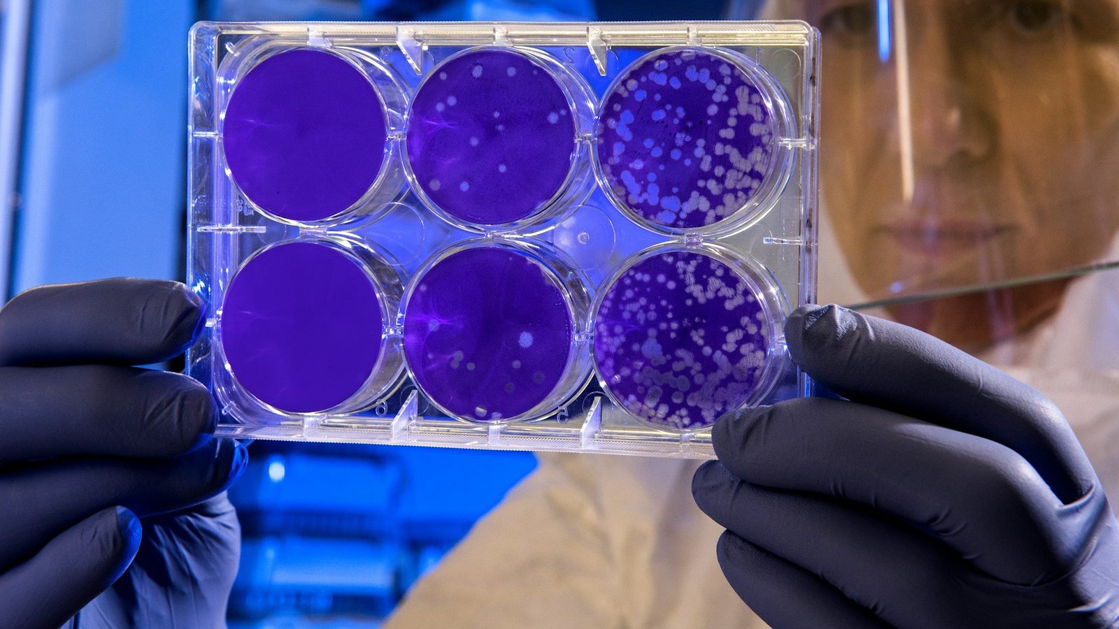 IA diseña virus biológicos nuevos nunca vistos en la naturaleza